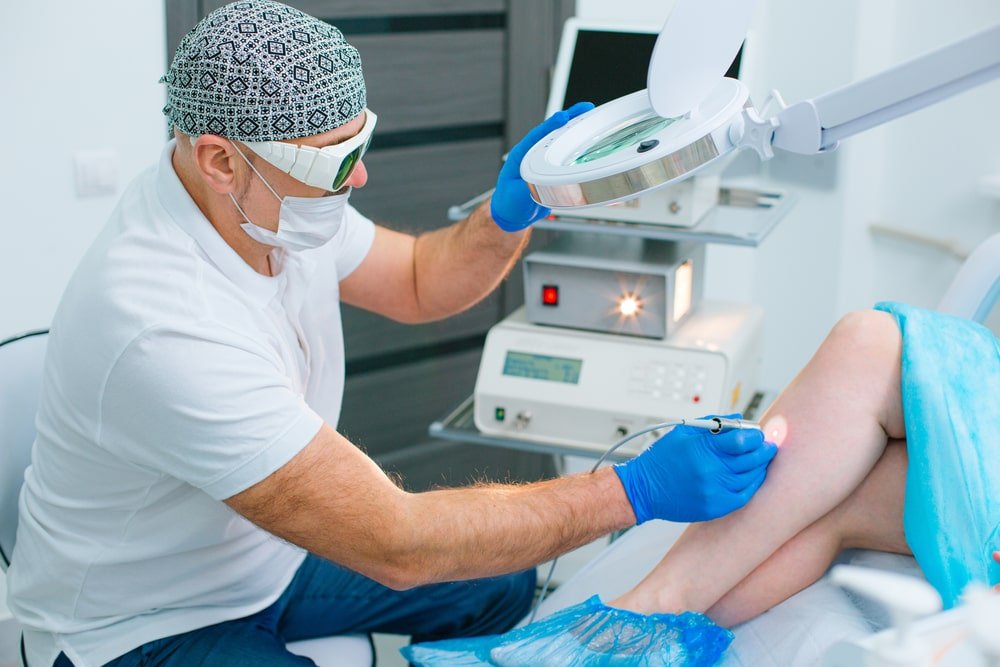 vein laser treatment