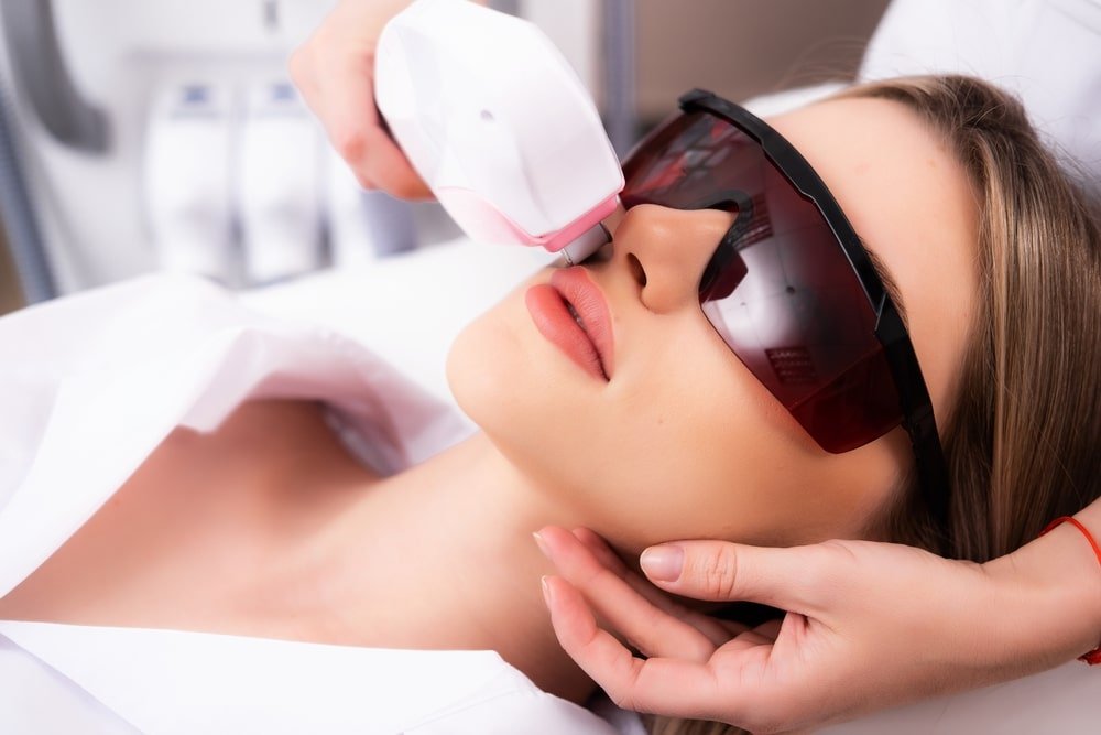 laser hair removal edgware